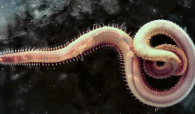 Fotos von Parasiten im menschlichen Körper