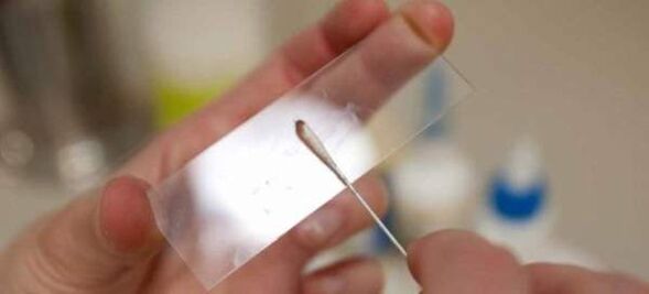 Kratzen nach Wurmeiern