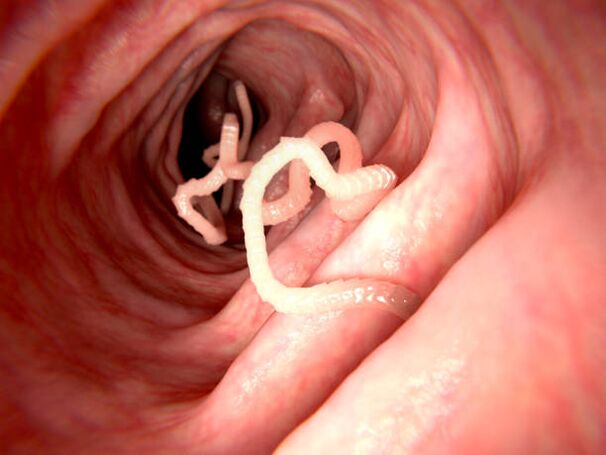 Parasiten im menschlichen Körper